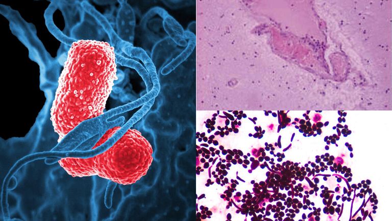 Бактерии Klebsiella pneumoniae, Weissella confusa и дрожжи Saccharomyces cerevisiae Бактерии Klebsiella pneumoniae, Weissella confusa и дрожжи Saccharomyces cerevisiae
