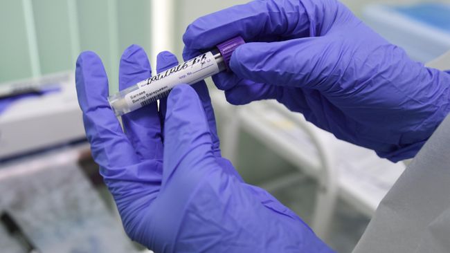 Сотрудник лаборатории держит в руках тест на COVID-19 Сотрудник лаборатории держит в руках тест на COVID-19