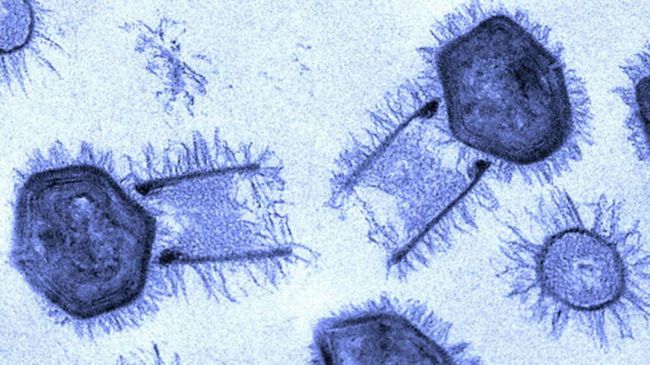 Вирионы Tupanvirus Вирионы Tupanvirus