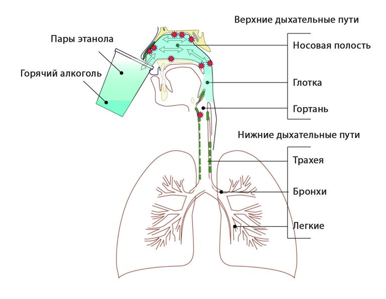 Вдыхание паров этанола для дезинфекции Вдыхание паров этанола для дезинфекции