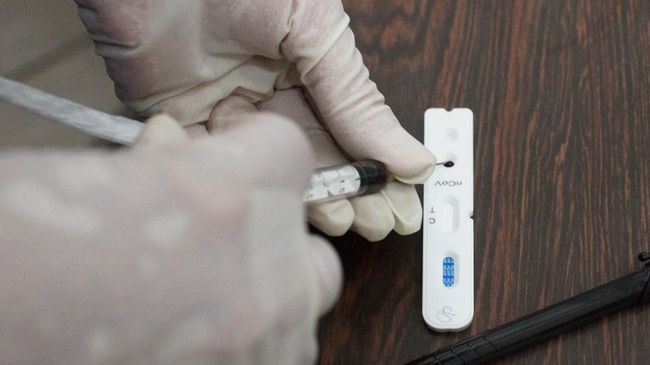 Медики проводят тестирование на коронавирус Медики проводят тестирование на коронавирус