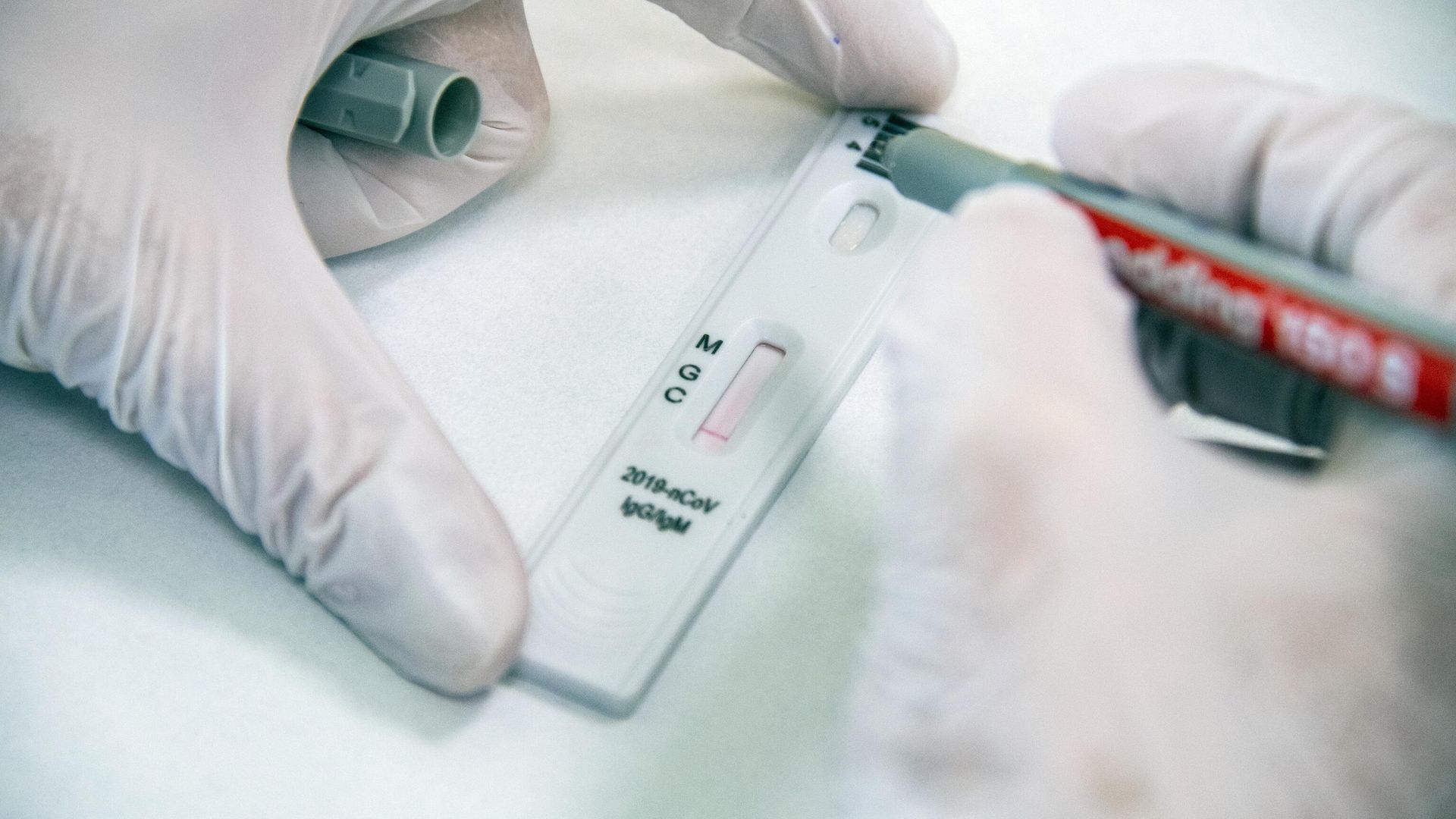 Экспресс-диагностика на антитела к коронавирусу в клинике Hadassah Medical Moscow в Сколково Экспресс-диагностика на антитела к коронавирусу в клинике Hadassah Medical Moscow в Сколково - РИА Новости, 1920, 17.10.2020