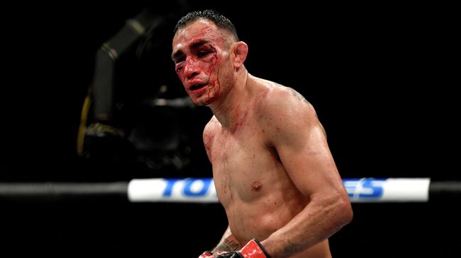 Американский боец смешанного стиля (MMA) Тони Фергюсон Американский боец смешанного стиля (MMA) Тони Фергюсон