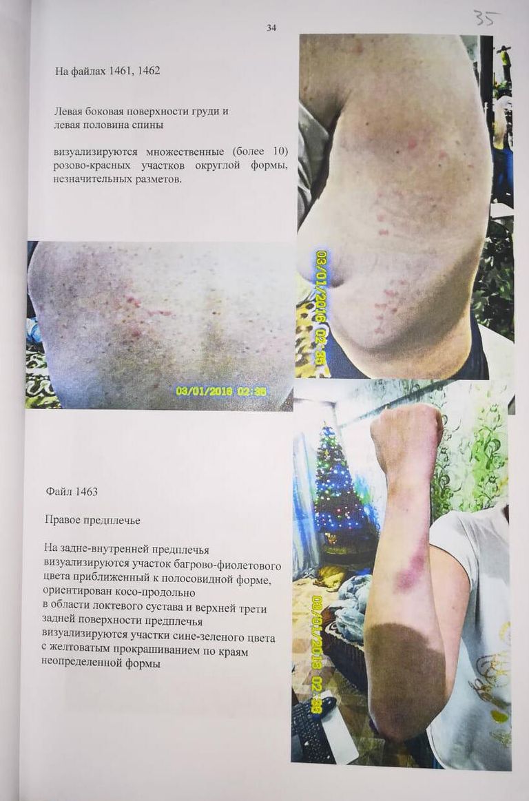 Фото побоев из материалов уголовного дела