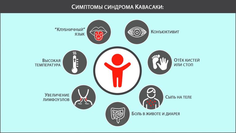 Симптомы синдрома Кавасаки