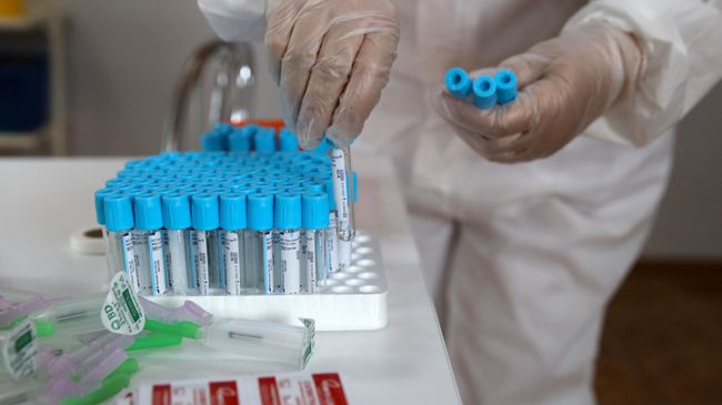 Пробирки для забора биоматериала для теста на наличие вируса COVID-19