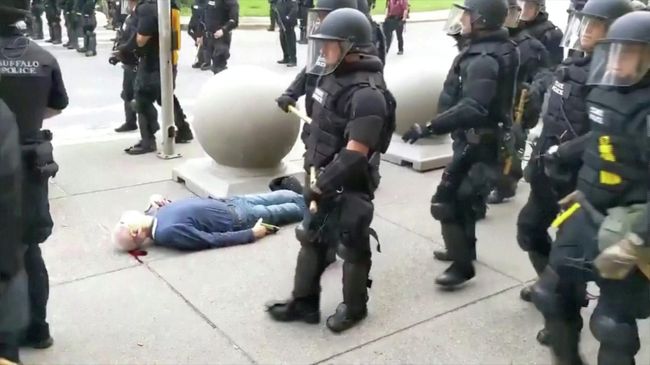 Офицеры полиции Баффало толкнули мужчину во время акции протеста Офицеры полиции Баффало толкнули мужчину во время акции протеста