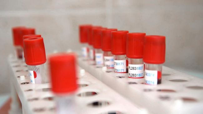 Пробирки с кровью для анализа перед выпиской добровольцев испытаний вакцины от коронавируса в Главном военном клиническом госпитале имени Н. Н. Бурденко