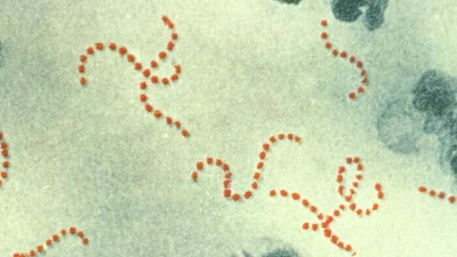 Streptococcus pyogenes под микроскопом