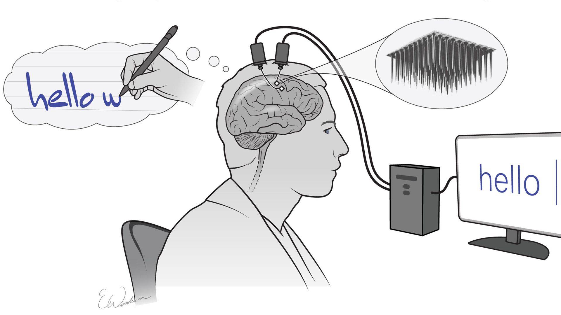 Интерфейс мозг-компьютер для набора текста по технологии Mindwriting Интерфейс мозг-компьютер для набора текста по технологии Mindwriting - РИА Новости, 1920, 12.05.2021