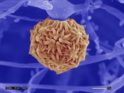 Зигоспора патогенного грибка Mucor circinelloides Зигоспора патогенного грибка Mucor circinelloides - РИА Новости, 1920, 28.05.2021