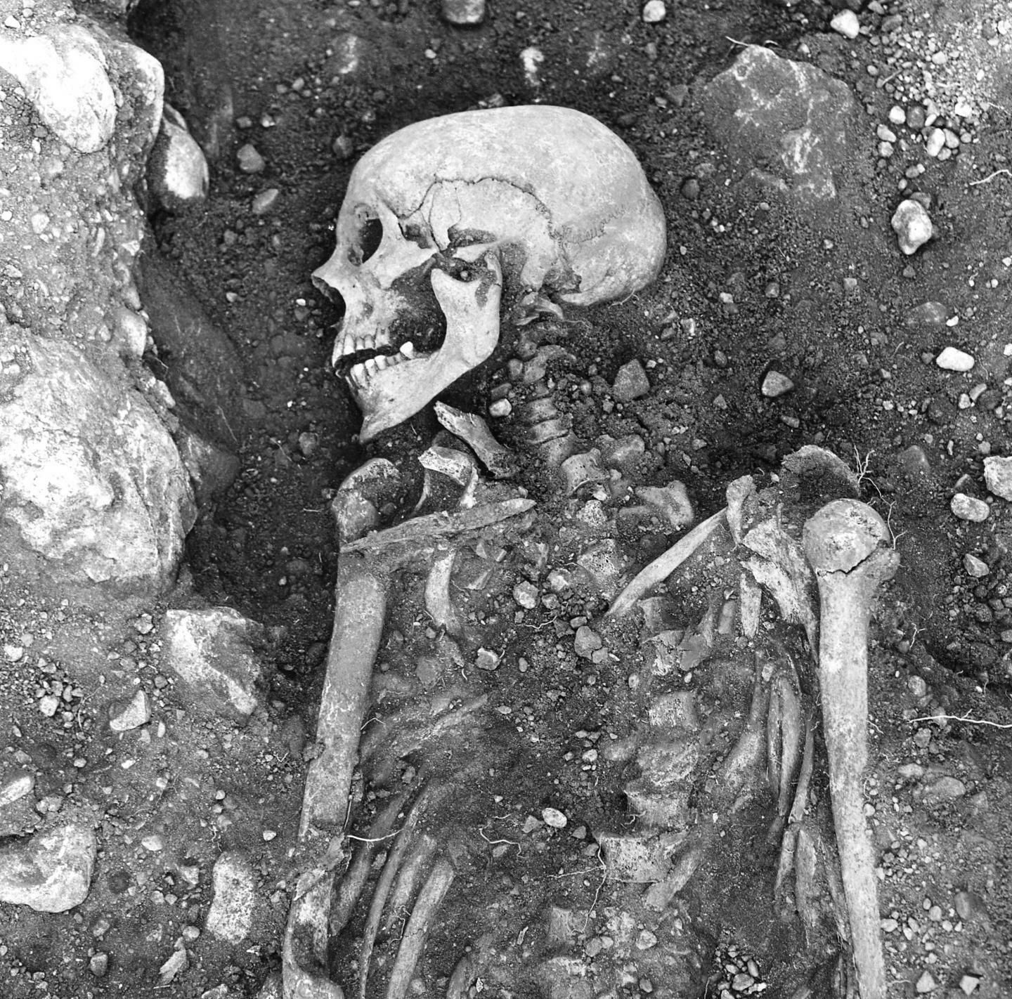 Скелет викинга возрастом 1200 лет, умершего от оспы Скелет викинга возрастом 1200 лет, умершего от оспы - РИА Новости, 1920, 03.08.2021