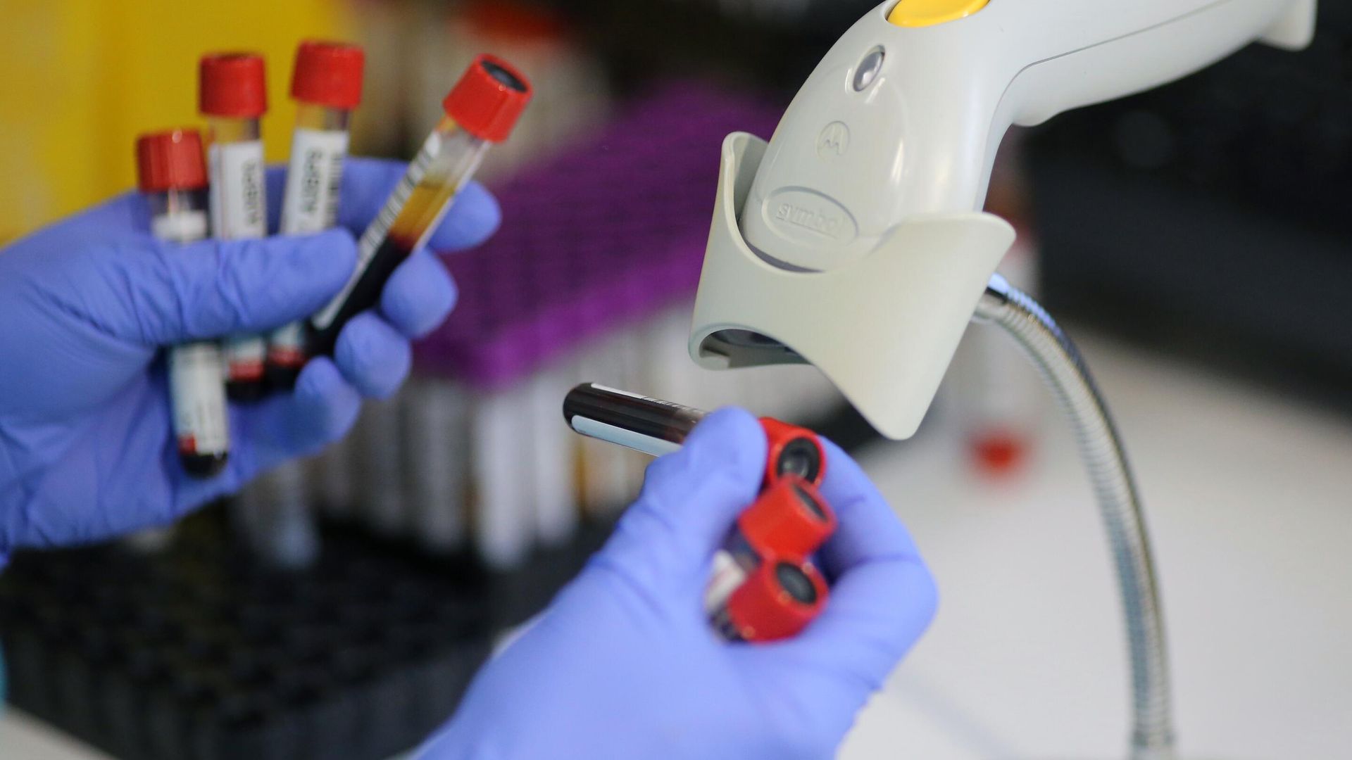 Пробирки с пробами крови в лаборатории Пробирки с пробами крови в лаборатории - РИА Новости, 1920, 13.10.2021