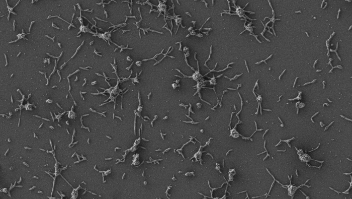Изображение клеток Mycoplasma pneumoniae, полученное с помощью сканирующего электронного микроскопа Изображение клеток Mycoplasma pneumoniae, полученное с помощью сканирующего электронного микроскопа - РИА Новости, 1920, 06.10.2021