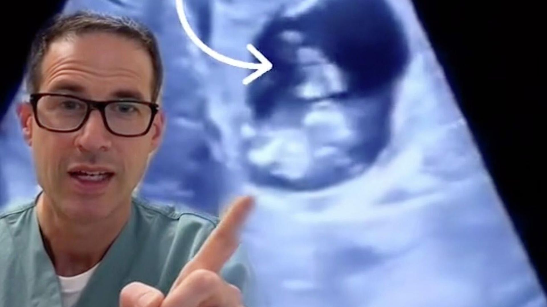 Where is this ectopic pregnancy Where is this ectopic pregnancy - РИА Новости, 1920, 17.12.2021
