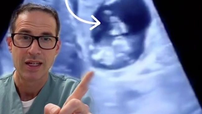Where is this ectopic pregnancy Where is this ectopic pregnancy