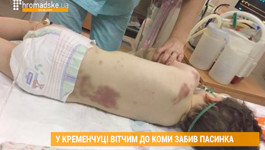 В Кременчуге отчим до комы забил пасынка. Стоп-кадр из видеорепортажа В Кременчуге отчим до комы забил пасынка. Стоп-кадр из видеорепортажа