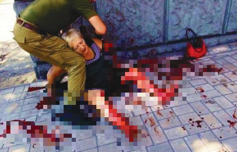 14.08.2014 года, район пересечения ул. Артёма и ул. 25–летия РККА, г. Донецк. Жертвы среди
мирного населения, в результате артиллерийского обстрела военными преступниками из Вооруженных Сил
Украины 14.08.2014 года, район пересечения ул. Артёма и ул. 25–летия РККА, г. Донецк. Жертвы среди
мирного населения, в результате артиллерийского обстрела военными преступниками из Вооруженных Сил
Украины
