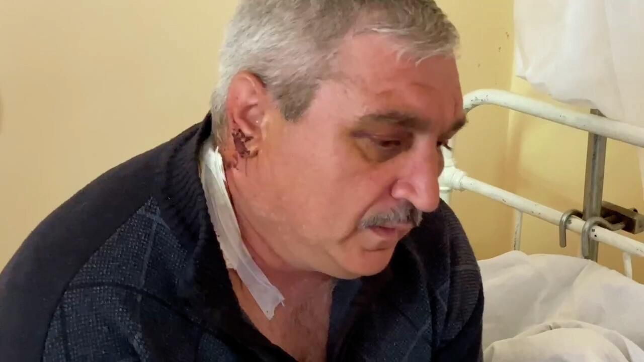 Полный ад – житель села на границе ЛНР и ДНР о беспорядочном огне по жилым домам Полный ад – житель села на границе ЛНР и ДНР о беспорядочном огне по жилым домам - РИА Новости, 1920, 07.05.2022