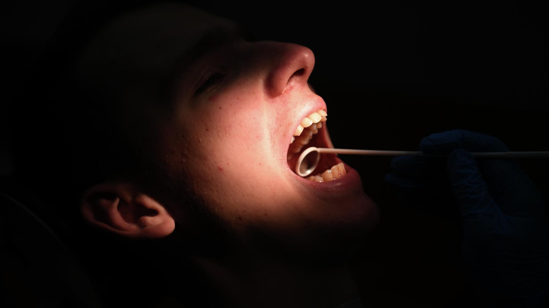 Осмотр полости рта Осмотр полости рта - РИА Новости, 1920, 17.08.2022