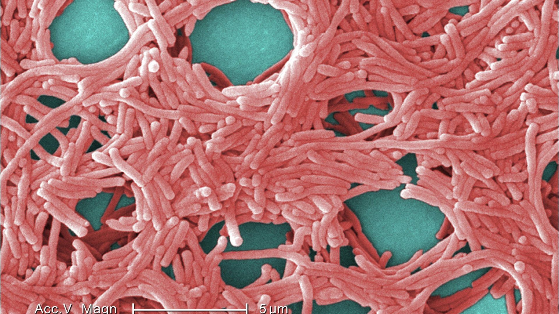 Бактерия Legionella pneumophila под электронным микроскопом Бактерия Legionella pneumophila под электронным микроскопом - РИА Новости, 1920, 31.08.2023