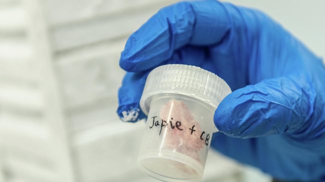 Замороженные образцы мозга Замороженные образцы мозга
