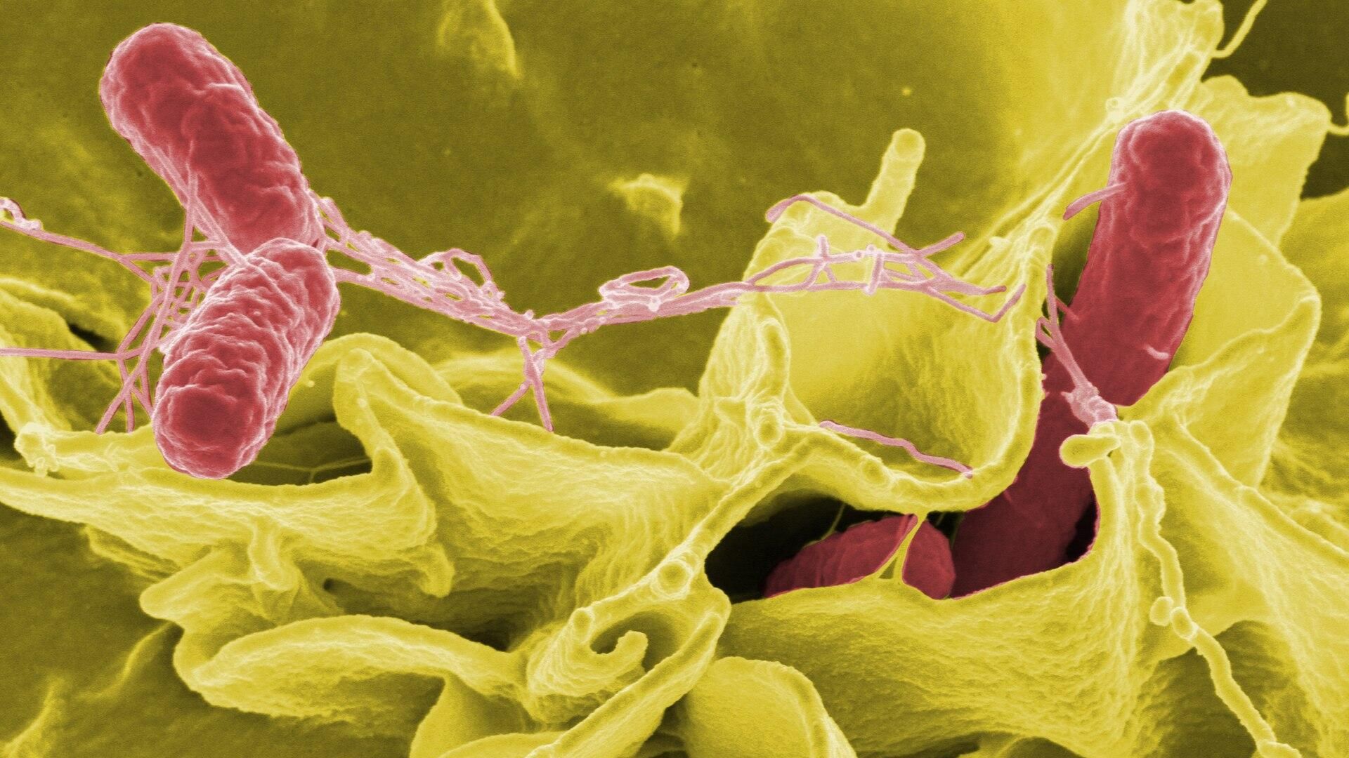 Раскрашенное изображение клеток Salmonella typhimurium (красные) в культуре клеток человека Раскрашенное изображение клеток Salmonella typhimurium (красные) в культуре клеток человека - РИА Новости, 1920, 18.10.2022