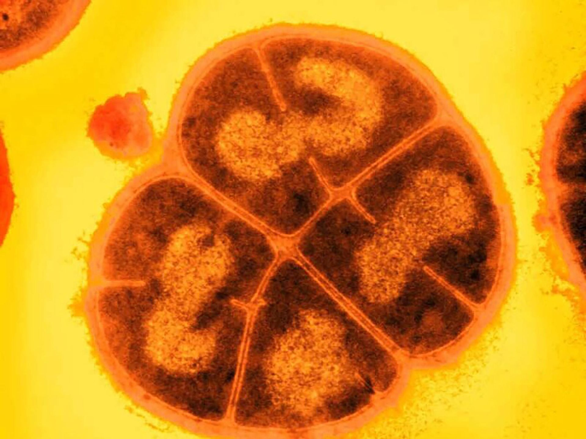 Deinococcus radiodurans Deinococcus radiodurans - РИА Новости, 1920, 28.10.2022