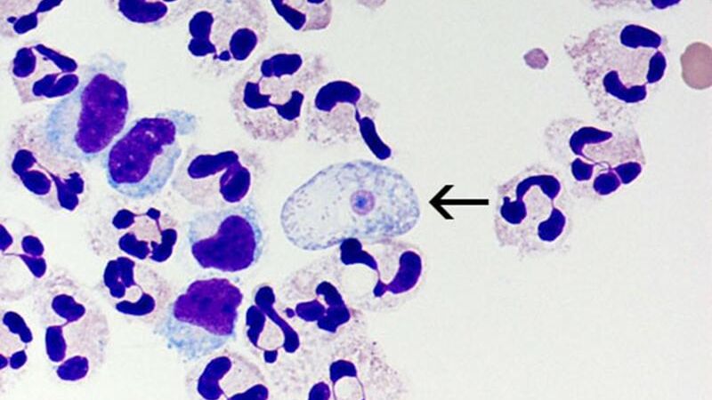 Амеба Naegleria fowleri под микроскопом Амеба Naegleria fowleri под микроскопом - РИА Новости, 1920, 28.12.2022