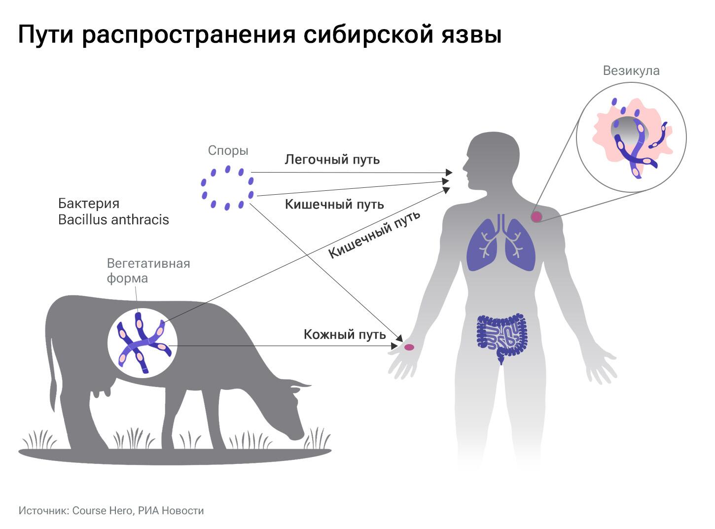 Сибирская язва Сибирская язва