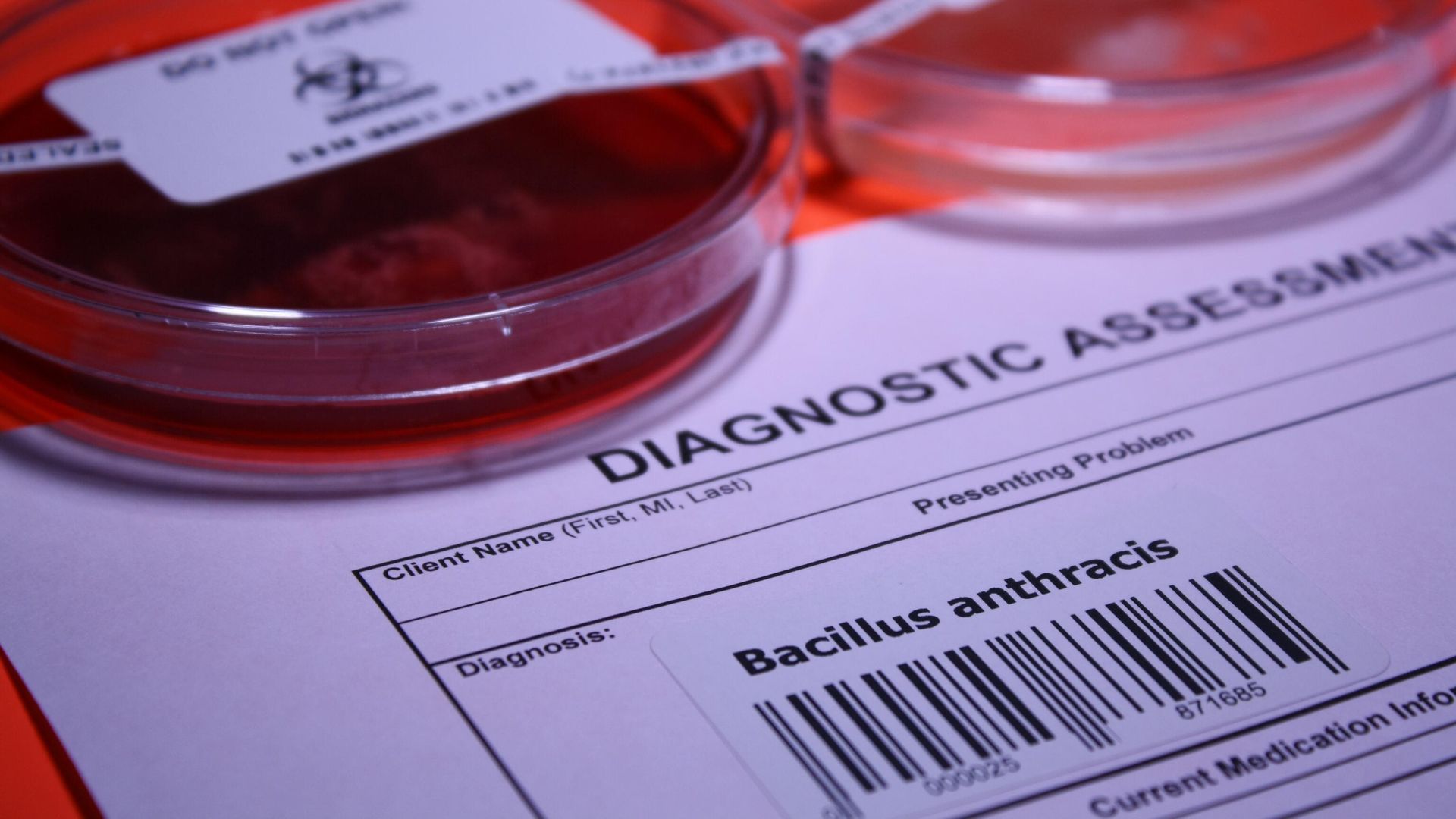 Палочка Bacillus anthracis Палочка Bacillus anthracis - РИА Новости, 1920, 24.03.2023
