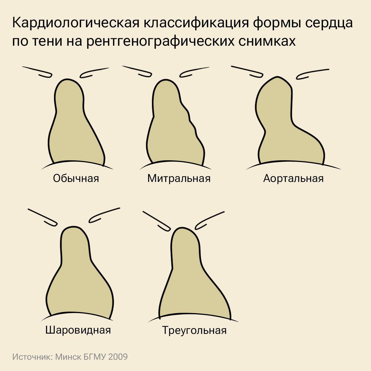 Форма сердца Форма сердца