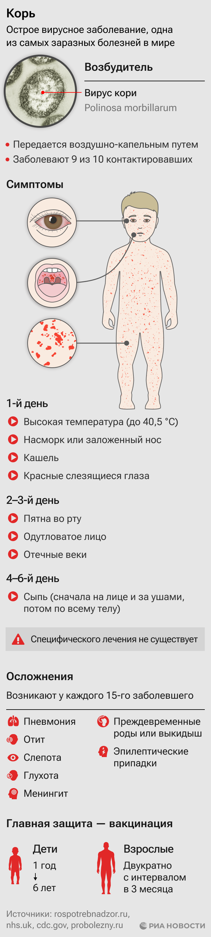 Корь: симптомы, осложнения и профилактика Корь: симптомы, осложнения и профилактика