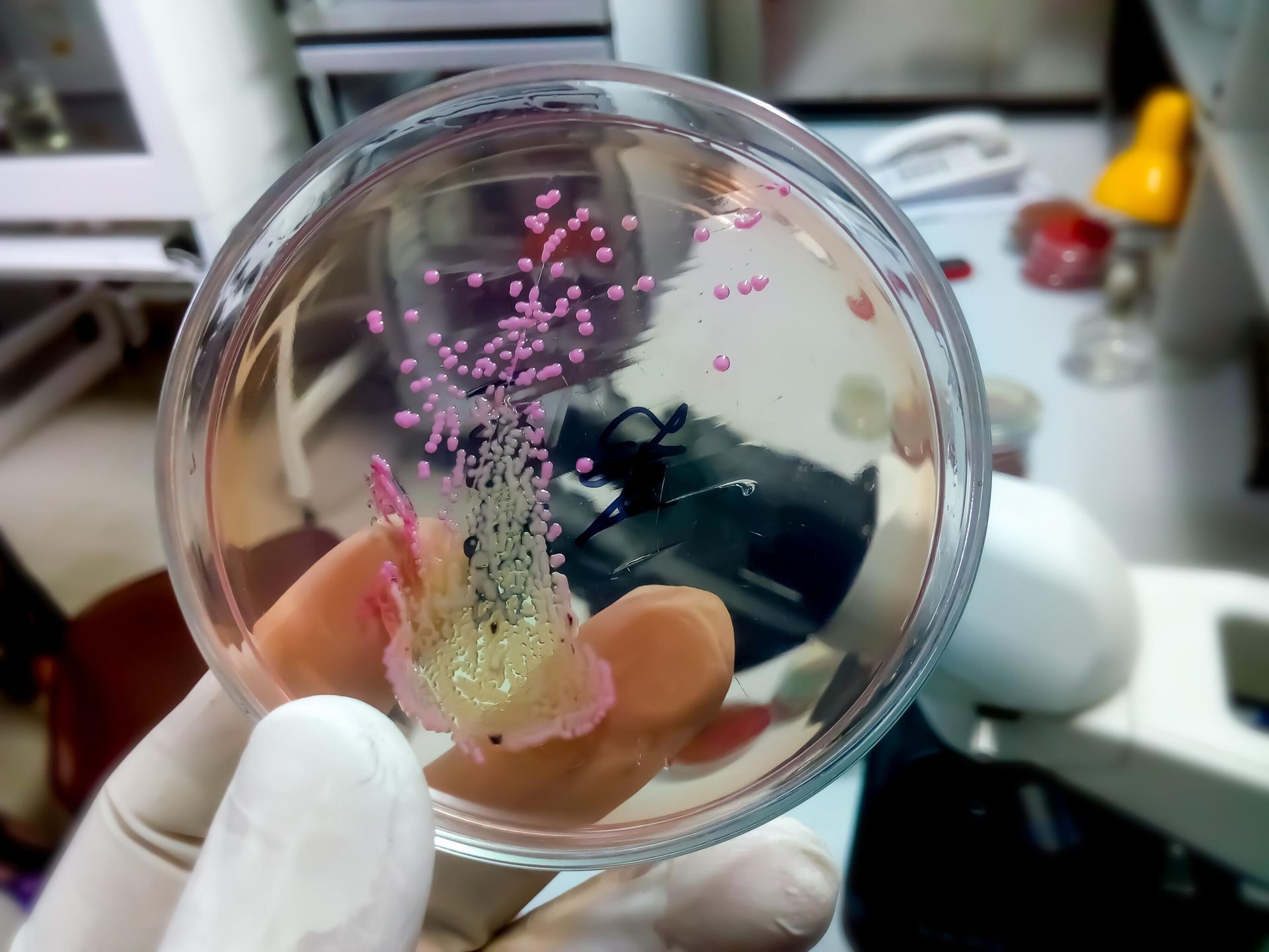 Бактерия Corynebacterium diphtheriae Бактерия Corynebacterium diphtheriae - РИА Новости, 1920, 11.05.2023