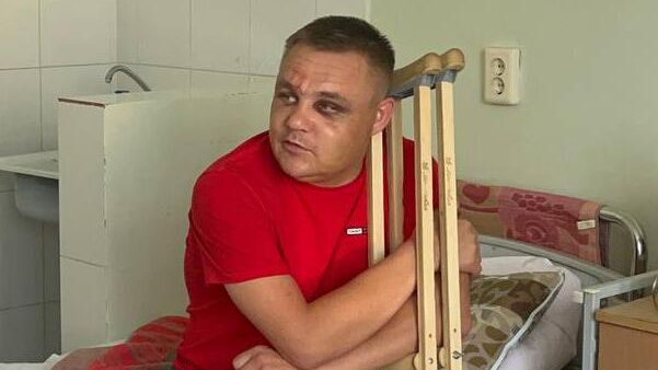 Ветеран СВО, избитый в Нерчинско-Заводском районе Ветеран СВО, избитый в Нерчинско-Заводском районе - РИА Новости, 1920, 08.08.2023