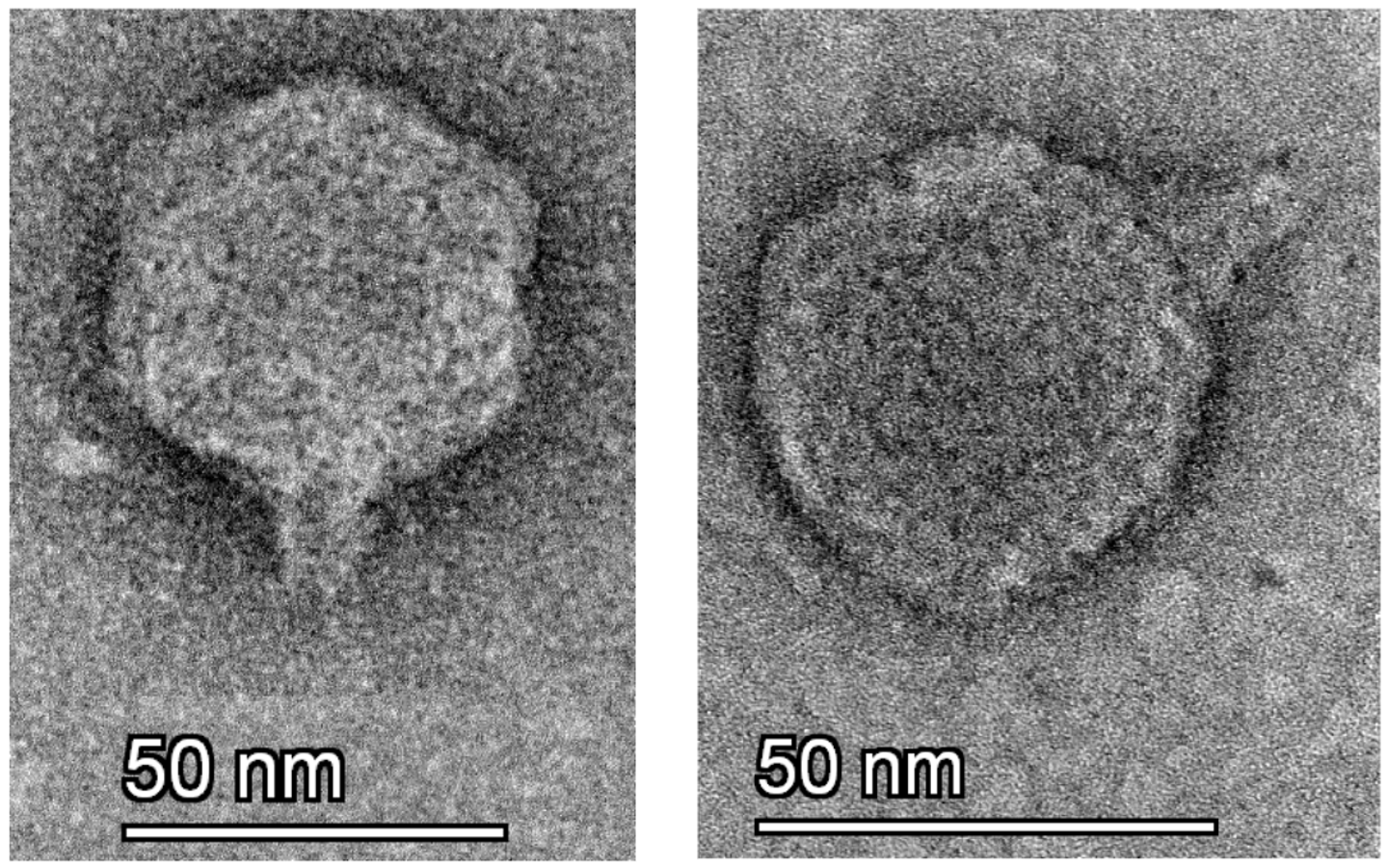 Электроннная микрофотография фага Т3 Электроннная микрофотография фага Т3