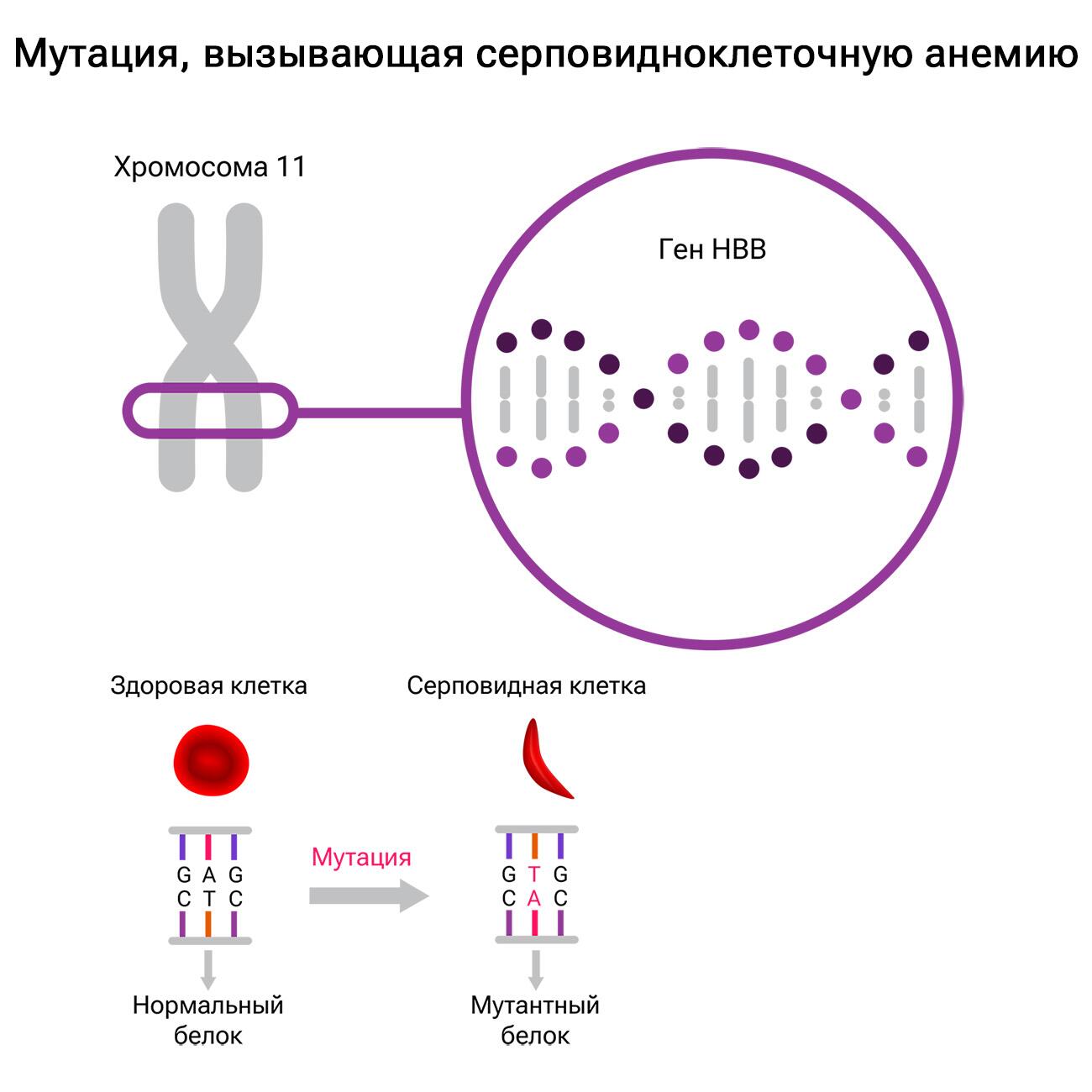 Мутация, вызывающая серповидноклеточную анемию