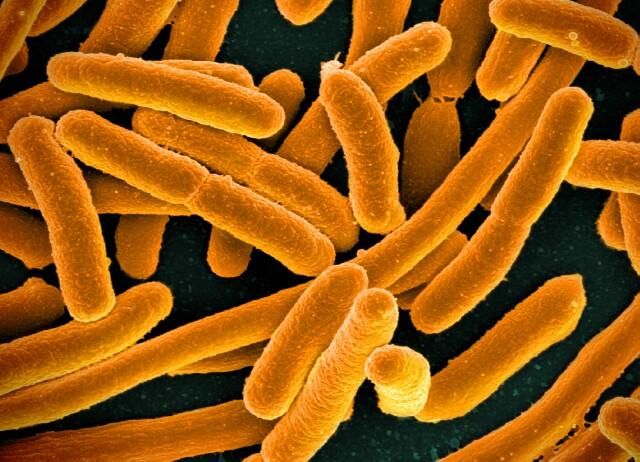 Колония Escherichia coli под микроскопом Колония Escherichia coli под микроскопом - РИА Новости, 1920, 15.10.2025
