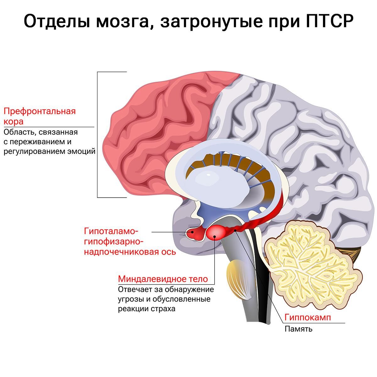 Отделы мозга, затронутые при ПТСР Отделы мозга, затронутые при ПТСР - РИА Новости, 1920, 25.01.2024