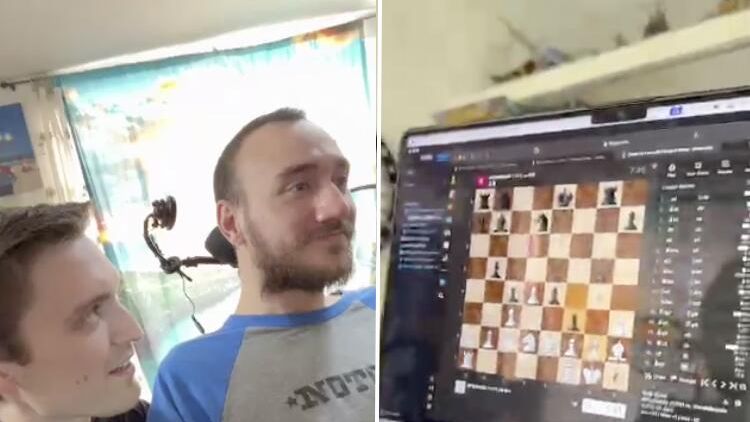 Первый пациент с имплантом компании Neuralink в мозге во время игры в шахматы Первый пациент с имплантом компании Neuralink в мозге во время игры в шахматы - РИА Новости, 1920, 21.03.2024