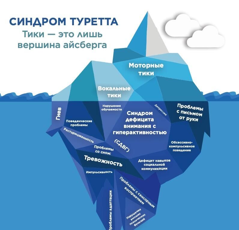 Синдром Туретта - РИА Новости, 1920, 06.06.2024