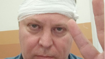Депутат Госдумы Михаил Матвеев после нападения в Самаре Депутат Госдумы Михаил Матвеев после нападения в Самаре - РИА Новости, 1920, 10.07.2025