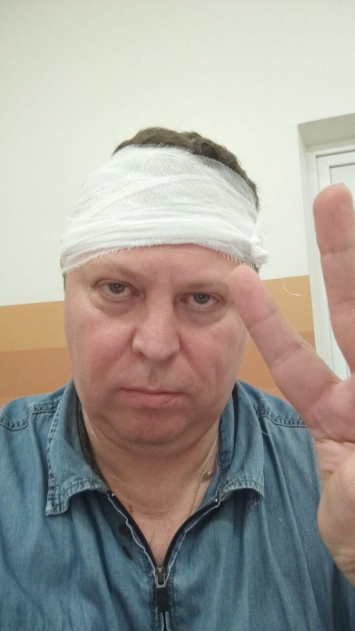 Депутат Госдумы Михаил Матвеев после нападения Депутат Госдумы Михаил Матвеев после нападения - РИА Новости, 1920, 20.07.2024