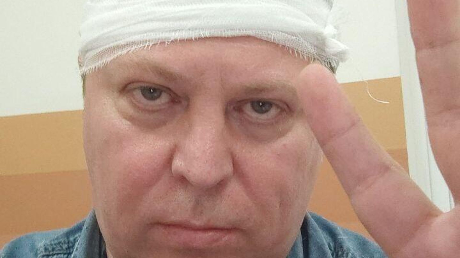 Депутат Госдумы Михаил Матвеев после нападения Депутат Госдумы Михаил Матвеев после нападения - РИА Новости, 1920, 18.07.2024