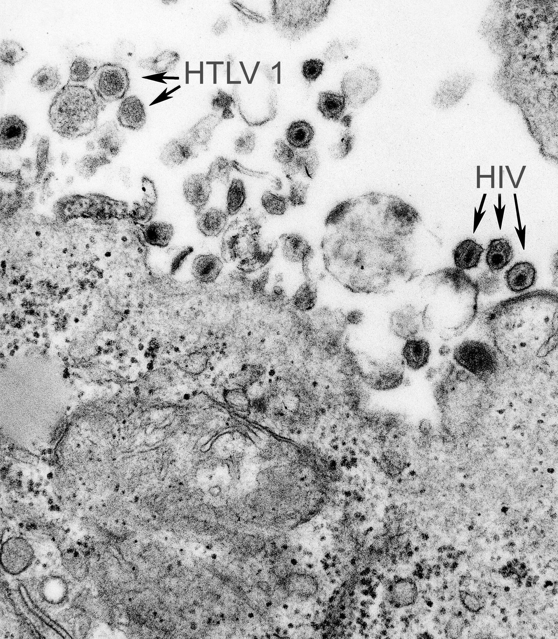 Клетки вируса HIV. 1980-е Клетки вируса HIV. 1980-е - РИА Новости, 1920, 21.02.2025