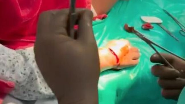 Врачи оперируют туристку из Москвы, на которую во время снорклинга напала акула