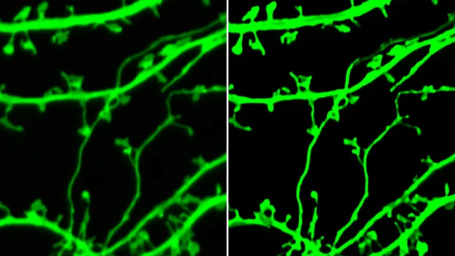 Изображение гиппокампального нейрона in vitro: до и после