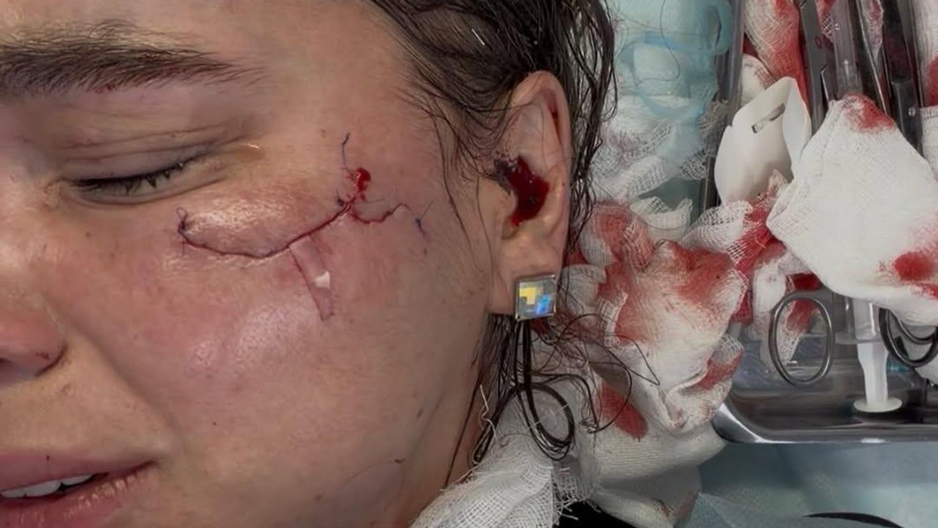 Победительница конкурса красоты из Кирова Надежда Шустова после удара бокалом Победительница конкурса красоты из Кирова Надежда Шустова после удара бокалом - РИА Новости, 1920, 03.03.2026