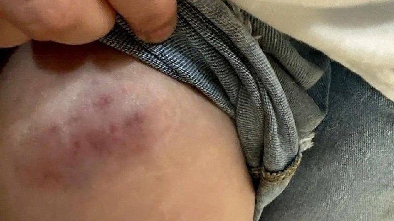 Последствия нападения обезьяны на несовершеннолетнего в Ростове-на-Дону - РИА Новости, 1920, 04.07.2026