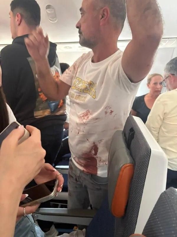 Пассажир рейса Flydubai со следами крови после инцидента в кабине пилотов Пассажир рейса Flydubai со следами крови после инцидента в кабине пилотов - РИА Новости, 1920, 30.09.2026